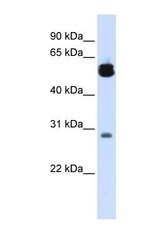 NBP1-56672 - 14-3-3 protein zeta/delta